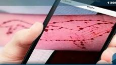 طفلة ترقد بالعيادة متعددة الخدمات بحي الوئام، بعد أن أقدمت على وشم صورة الحوت الأزرق بيدها.